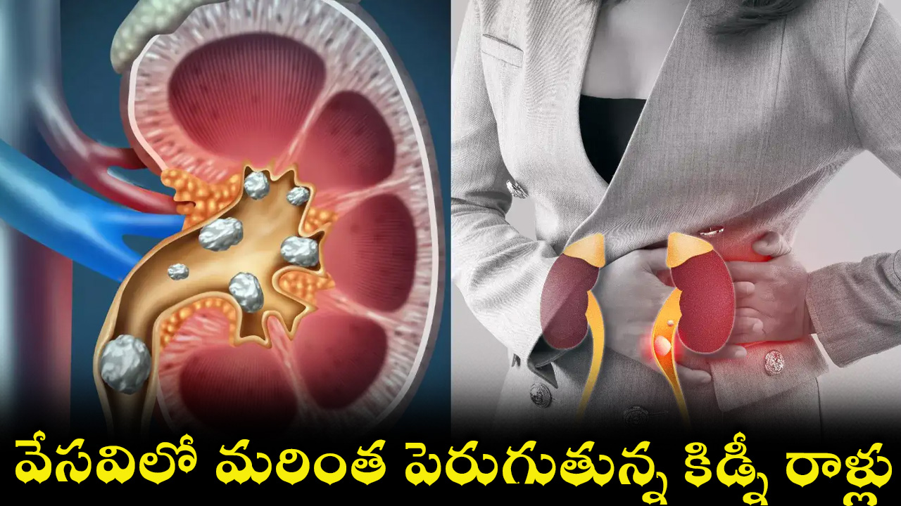 kidney-29.jpg